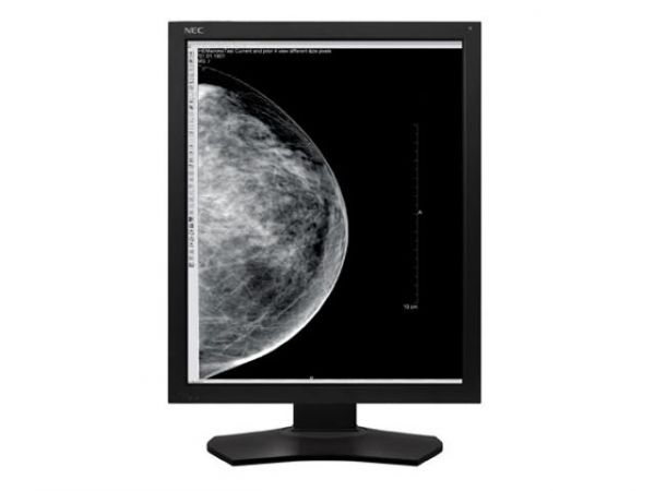 NEC Medical Display MD215MG 21&quot; 2048 x 2560 5MP 500cd/m² FDA 510(k) 256 Graustufen